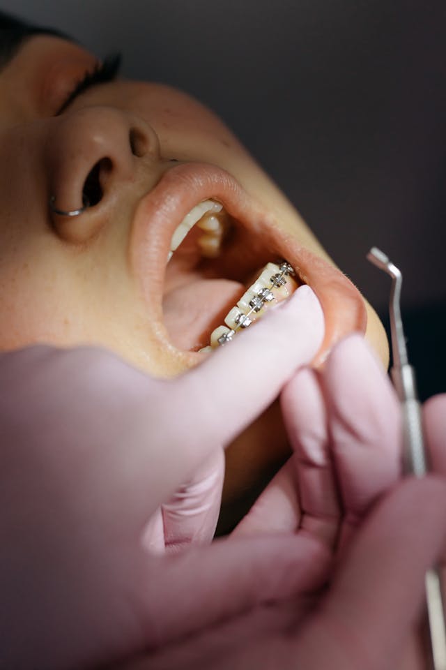 Orthodontics and Dentofacial Orthopedics